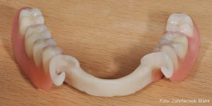 Sonderkunststoff Flexiplast Flexistron gür biokompatiblen Zahnersatz