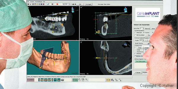 Vorbereritung eienr Implantation