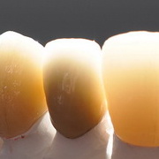 frontmetall180